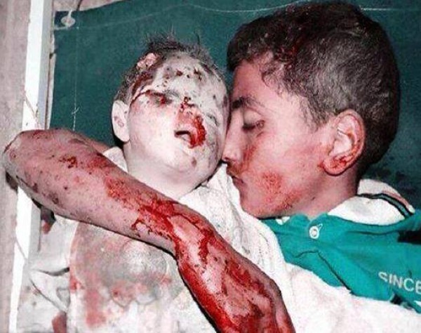Photo of Gazze’de Yıkılan Evin Enkazından Bir Gencin Küçük Kardeşine Sarılmış Halde Naaşı Çıkarıldı