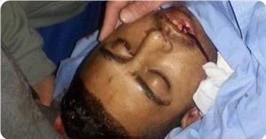 Photo of 21 yaşındaki Filistinli genç Mahmud Abdullah Udvan şehid edildi
