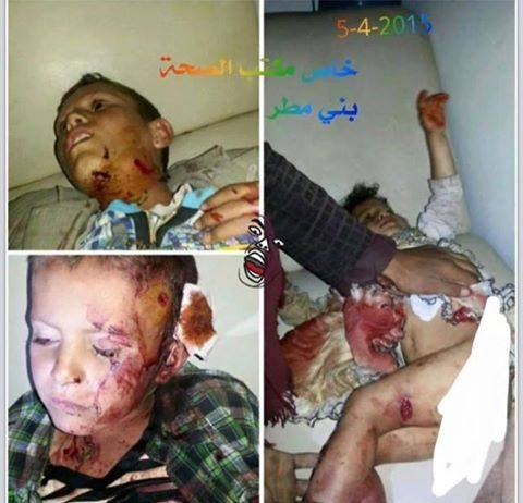 Photo of FOTO-Suriye İçin Sahta Gözyaşı Dökenler, Yemen Katliamını Destekliyorlar