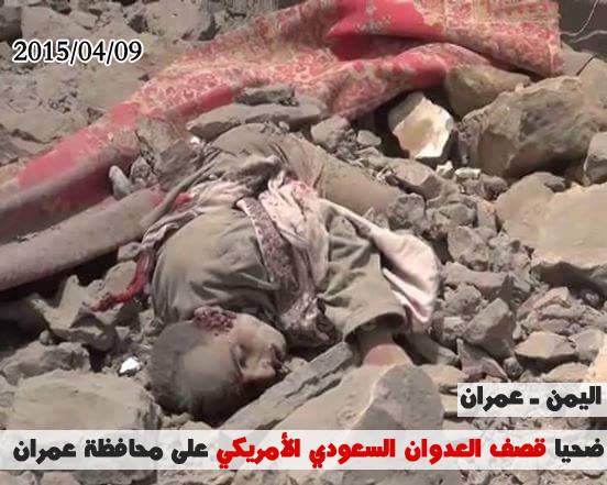 Photo of FOTO-Siyonist Suud Rejimi İle Körfez Ülkelerine Bağlı Savaş Uçakları Yemen’de Sivil Yerleşim Birimlerini Vurdular