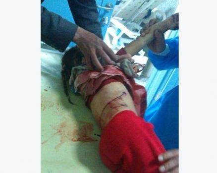 Photo of Siyonist Suudiler ve destekçileri Yemen’de yine sivil katliamı yaptılar