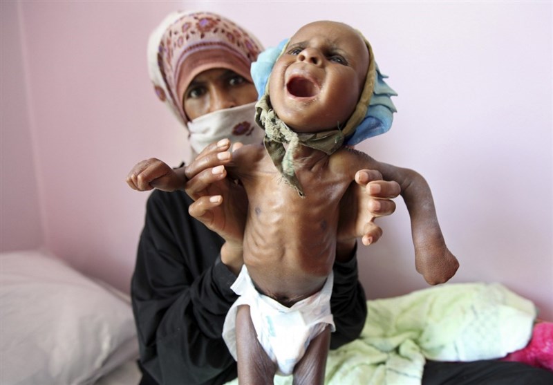 Photo of Her 10 Dakikada Yemenli Bir Çocuk Açlıktan Ölüyor