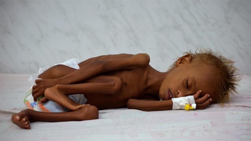 Photo of Yemen’li çocuklar, Arabistan’ın savaş çığırtkanlığının ilk kurbanları