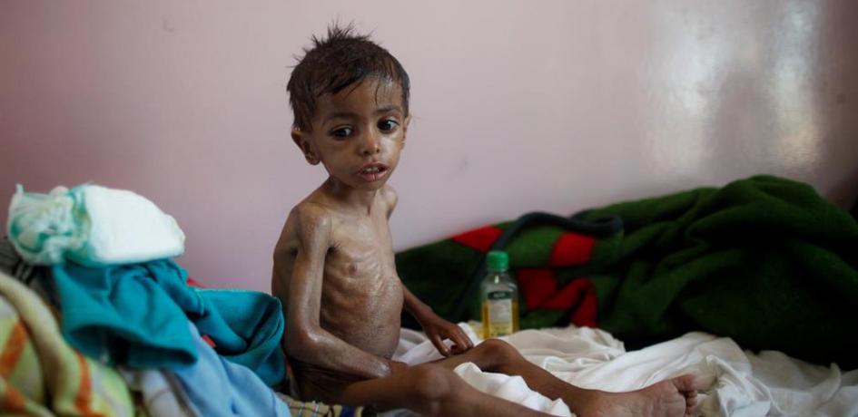 Photo of UNICEF: Günde 5 Yemenli çocuk Suudilerin saldırılarında ölmekte